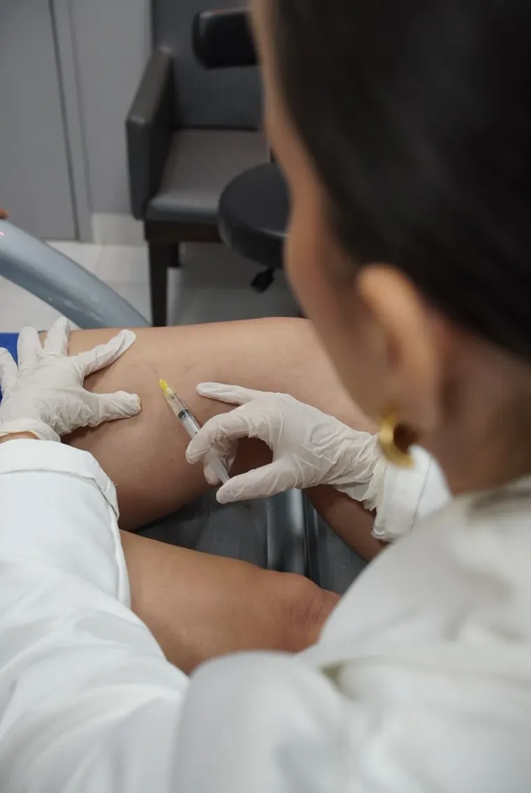 Aplicação de escleroterapia em consultório